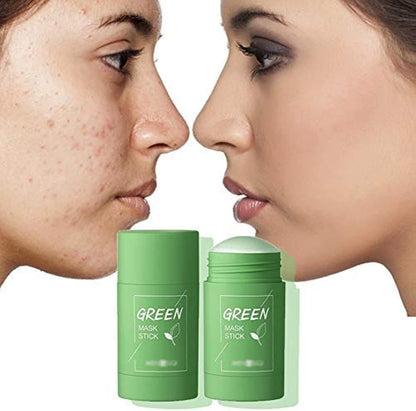 Magic Green Stick Mask – Deep Cleansing & Pore-Tightening for Acne