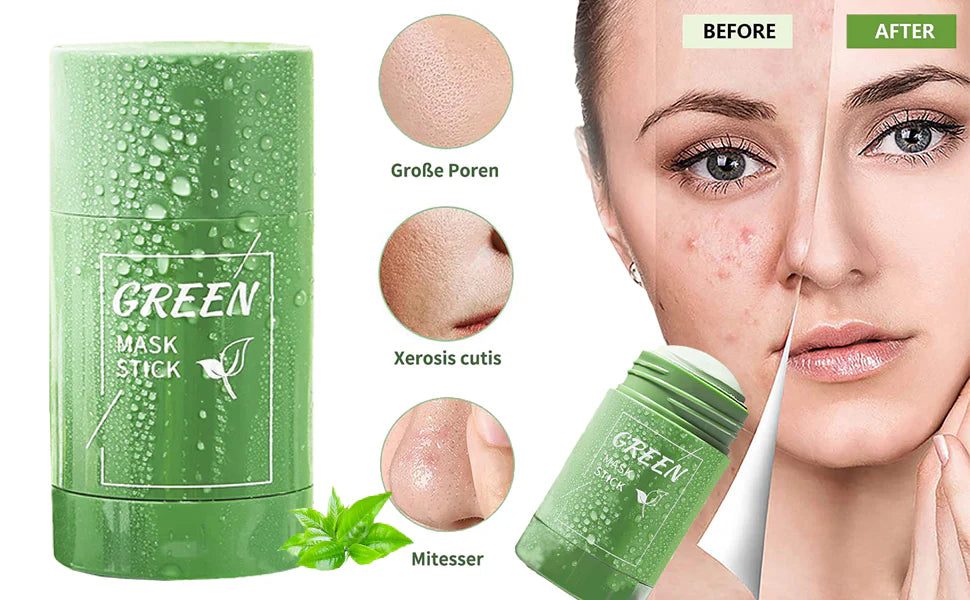 Magic Green Stick Mask – Deep Cleansing & Pore-Tightening for Acne