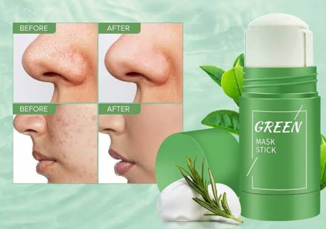 Magic Green Stick Mask – Deep Cleansing & Pore-Tightening for Acne