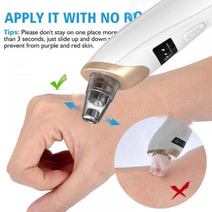 5 In 1 Blackhead Remover Vacuum with LED