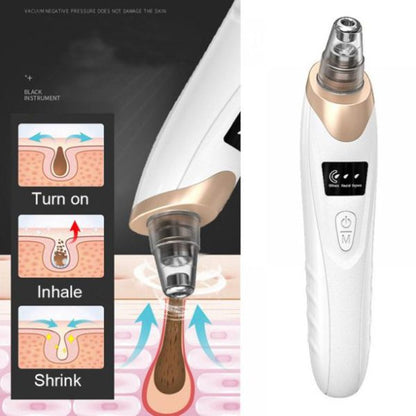 5 In 1 Blackhead Remover Vacuum with LED